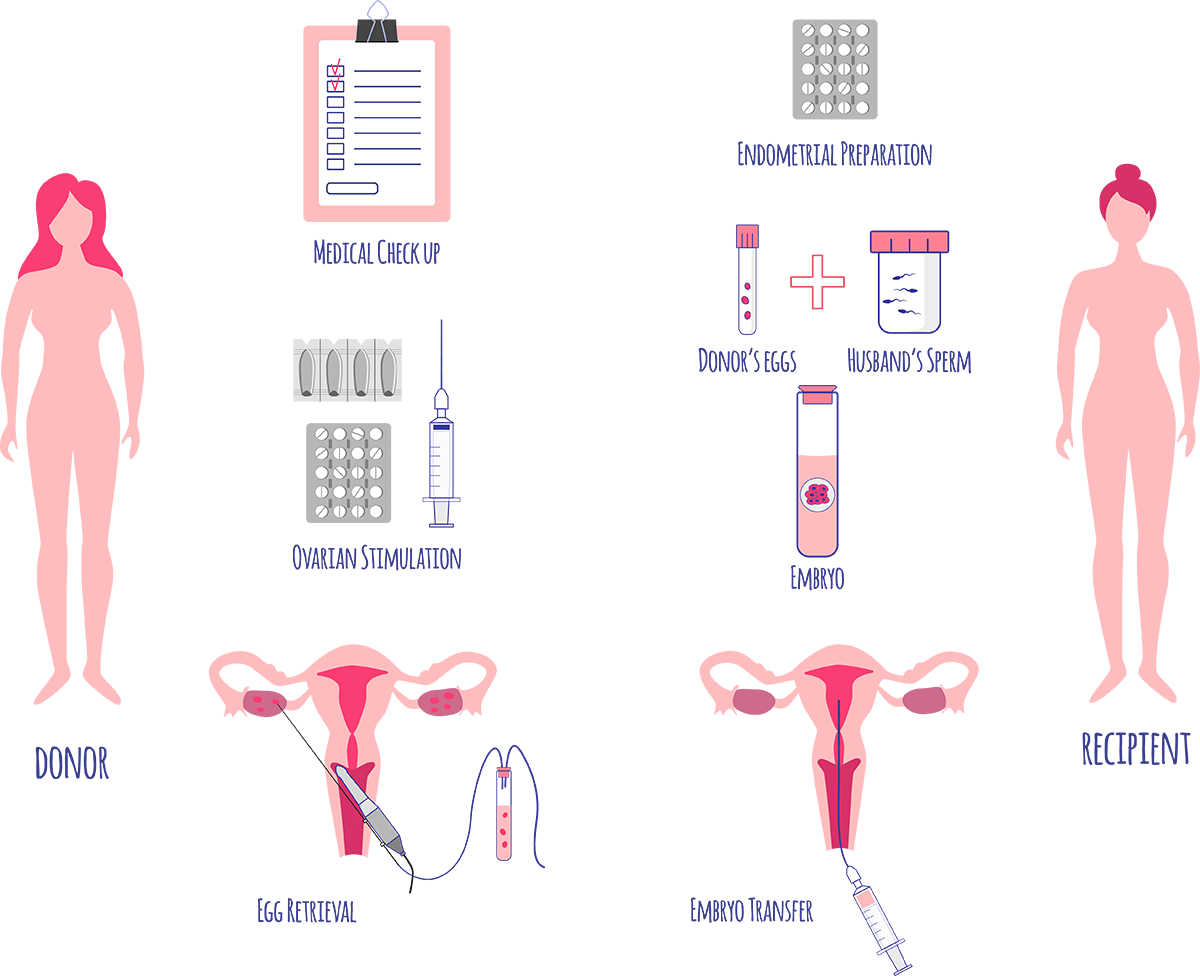 process for using donor eggs for IVF