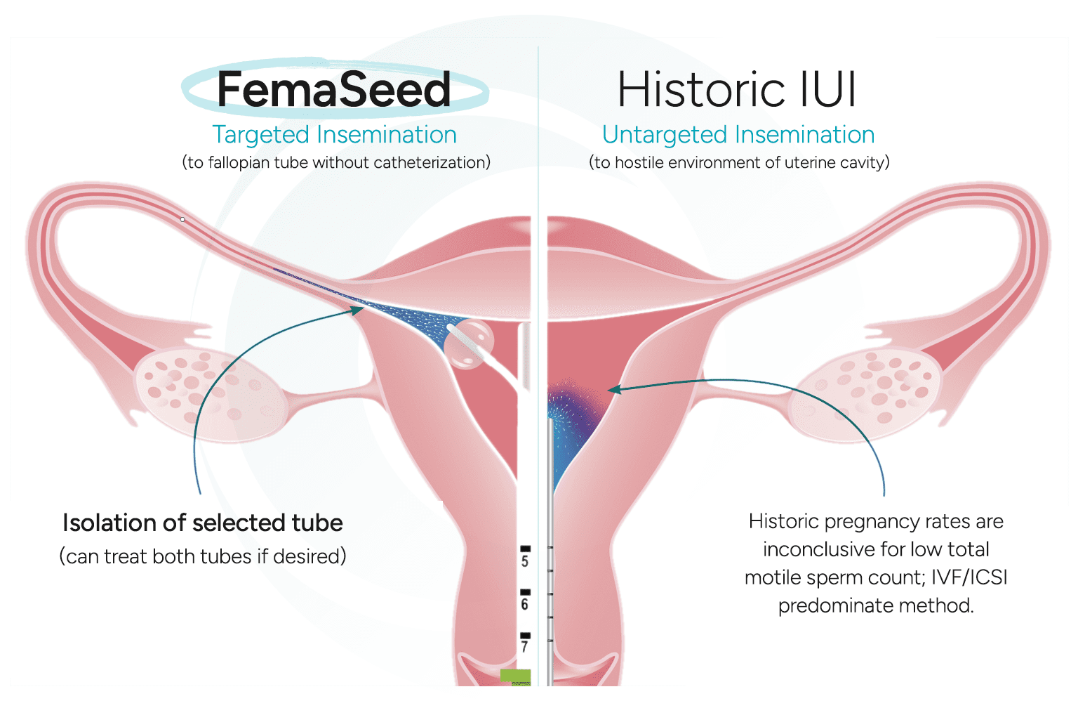 The FemaSeed Difference